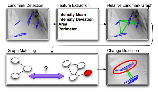 Landmark
detection and comparison process